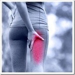 Is Piriformis Syndrome the Cause of My Sciatica?