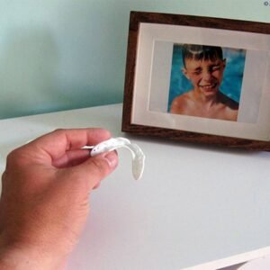Night Time Dental Guard